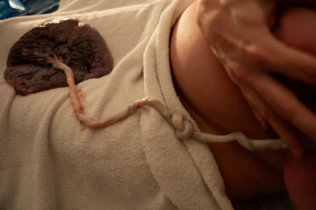 parto placenta
