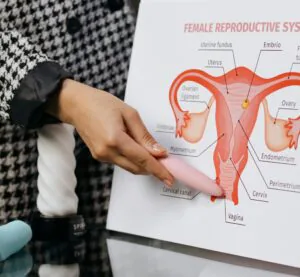 preventivo papanicolau